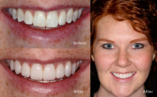 Cosmetic Dentist In Fitchburg Adjacent To Madison Wisconsin Wis WI