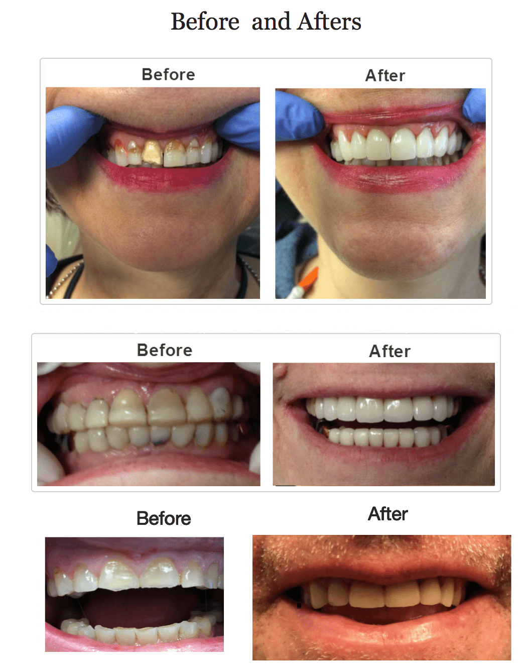 Cosmetic Dentist In Five Points Huntsville Alabama Ala AL