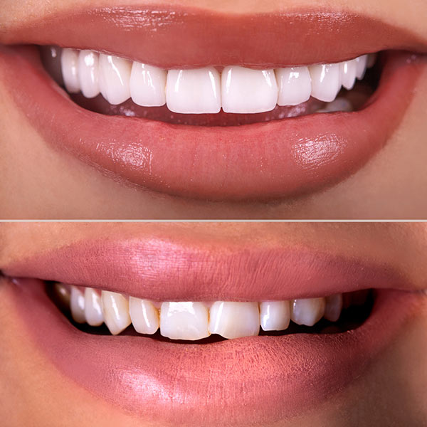 Cosmetic Dentist In Forest Hills Augusta Georgia GA Cosmetic Dentist In Forest Hills Augusta Georgia GA