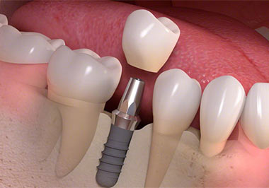 Cosmetic Dentist In Glenwood Yonkers New York NY Cosmetic Dentist In Glenwood Yonkers New York NY
