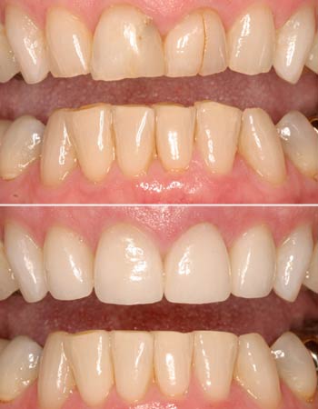Cosmetic Dentist In Goodyear Heights Akron Ohio OH Cosmetic Dentist In Goodyear Heights Akron Ohio OH
