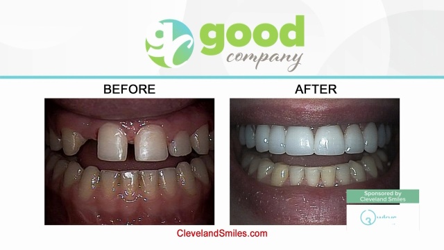 Cosmetic Dentist In Gordon Square Cleveland Ohio OH Cosmetic Dentist In Gordon Square Cleveland Ohio OH