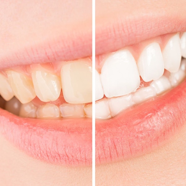 Cosmetic Dentist In Greenville Jersey City New Jersey NJ Cosmetic Dentist In Greenville Jersey City New Jersey NJ
