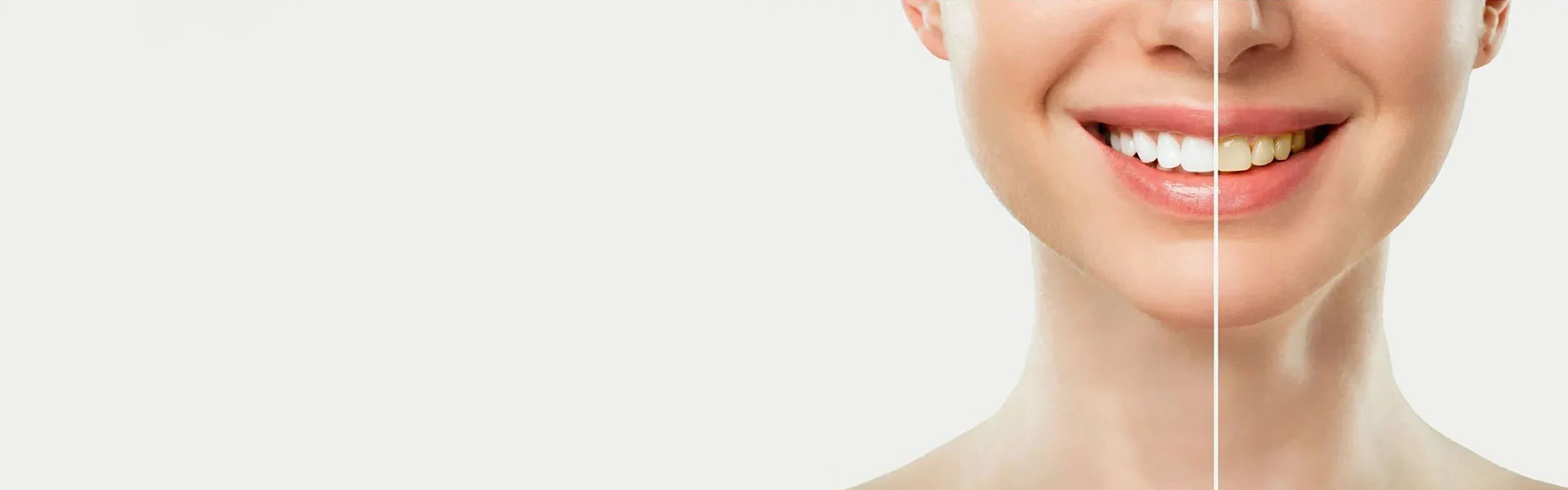 Cosmetic Dentist In Gulfport Adjacent To St Petersburg Florida Fla FL Cosmetic Dentist In Gulfport Adjacent To St Petersburg Florida Fla FL