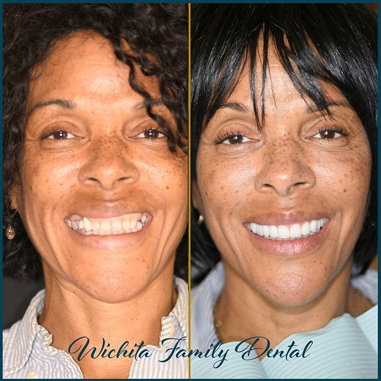 Cosmetic Dentist In Haysville Adjacent To Wichita Kansas Kan KS Cosmetic Dentist In Haysville Adjacent To Wichita Kansas Kan KS