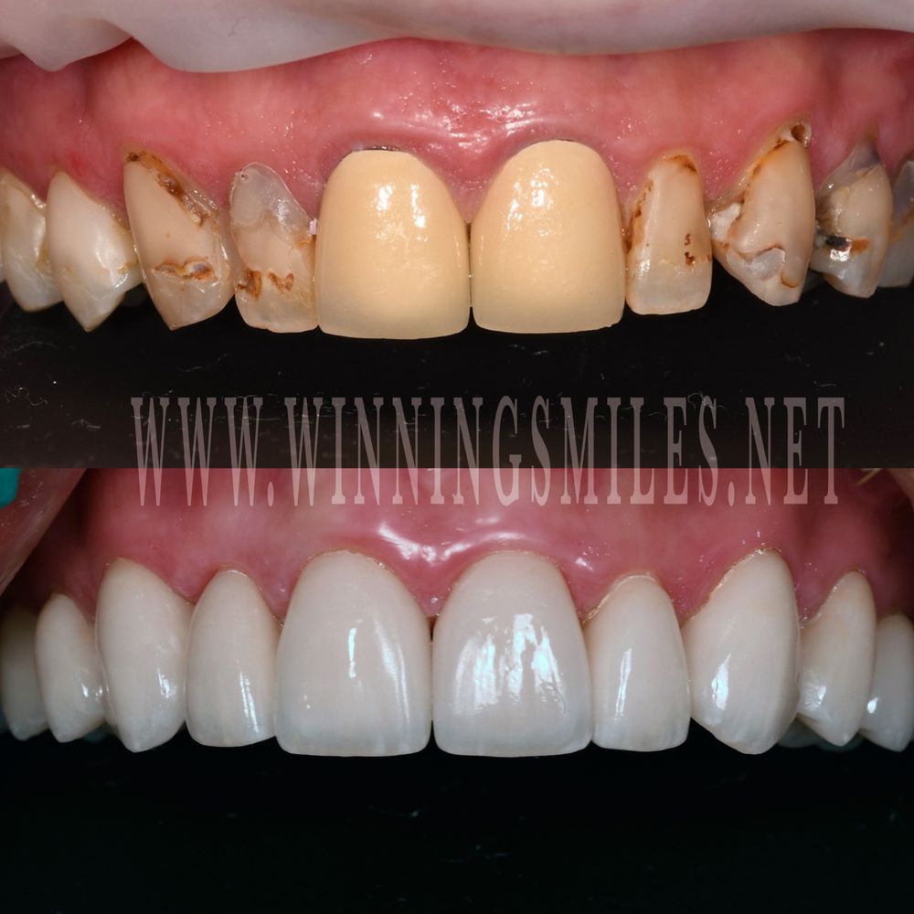 Cosmetic Dentist In Highland Adjacent To San Bernardino California Calif CA