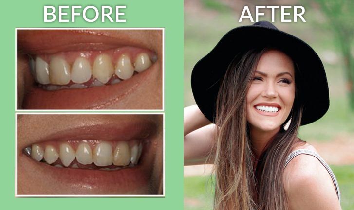 Cosmetic Dentist In Highland Park Birmingham Alabama Ala AL