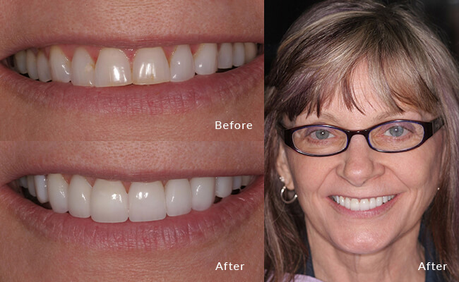 Cosmetic Dentist In Hilldale Madison Wisconsin Wis WI