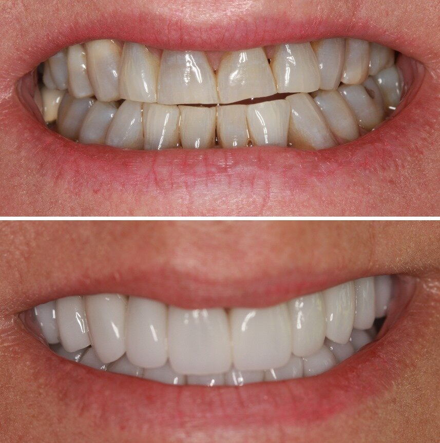 Cosmetic Dentist In Hillside Terrace Amarillo Texas TX