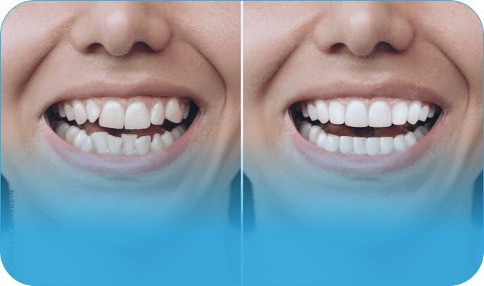 Cosmetic Dentist In Hope Valley Durham North Carolina NC Cosmetic Dentist In Hope Valley Durham North Carolina NC