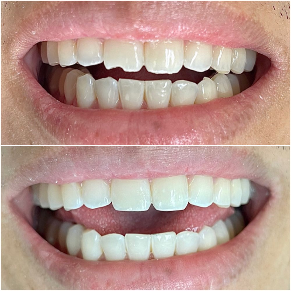 Cosmetic Dentist In Huntington Beach Central Park Huntington Beach California Calif CA