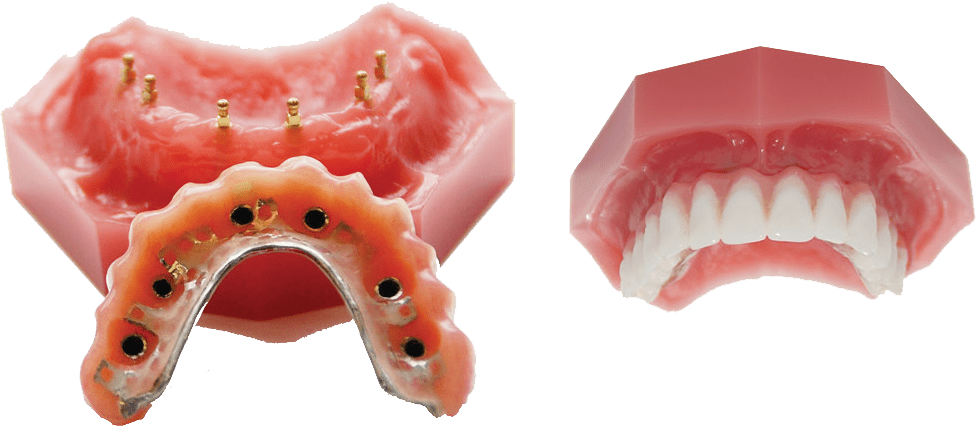 Cosmetic Dentist In Kaisertown Buffalo New York NY Cosmetic Dentist In Kaisertown Buffalo New York NY
