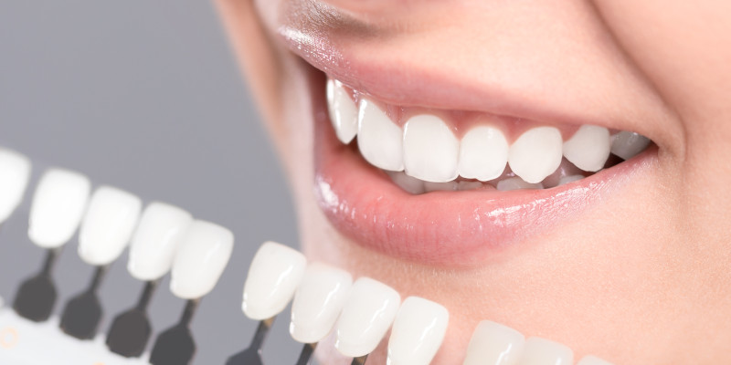 Cosmetic Dentist In Kernersville Adjacent To Winston Salem North Carolina NC Cosmetic Dentist In Kernersville Adjacent To Winston Salem North Carolina NC