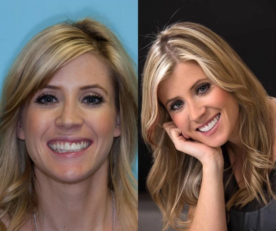 Cosmetic Dentist In Laguna Altura Irvine California Calif CA Cosmetic Dentist In Laguna Altura Irvine California Calif CA