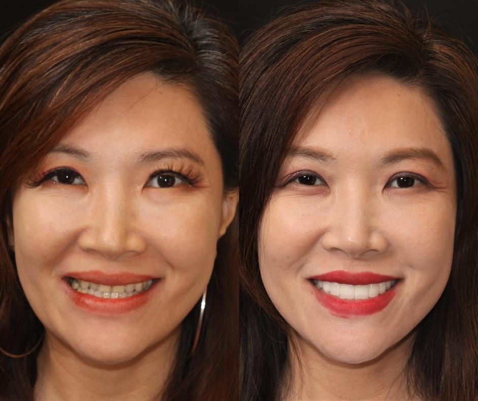 Cosmetic Dentist In Laguna Altura Irvine California Calif CA Cosmetic Dentist In Laguna Altura Irvine California Calif CA