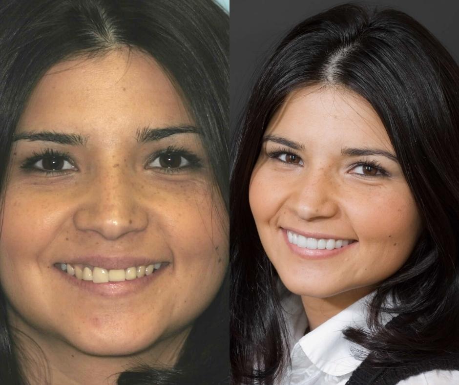 Cosmetic Dentist In Laguna Altura Irvine California Calif CA Cosmetic Dentist In Laguna Altura Irvine California Calif CA