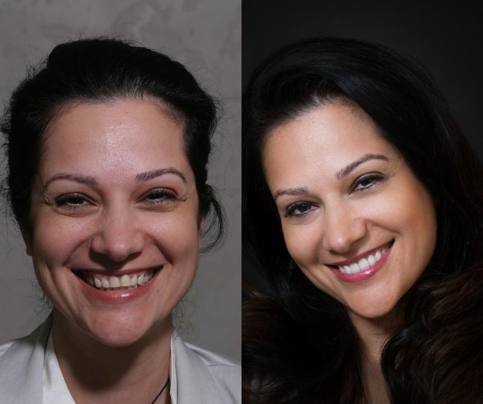 Cosmetic Dentist In Laguna Altura Irvine California Calif CA Cosmetic Dentist In Laguna Altura Irvine California Calif CA