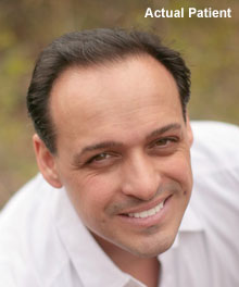 Cosmetic Dentist In Lakewood Denver Colorado Colo CO