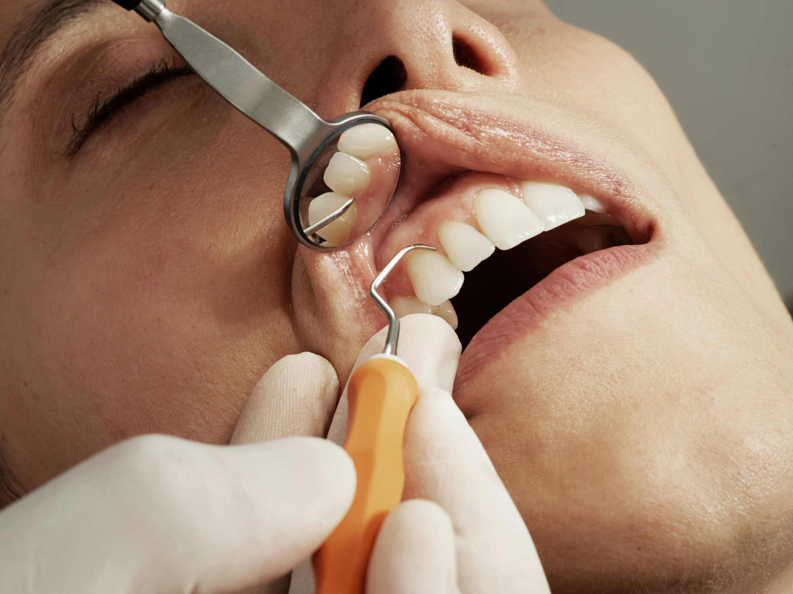 Cosmetic Dentist In Lancaster Acres Lancaster California Calif CA