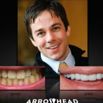 Cosmetic Dentist In Las Sendas Mesa Arizona Ariz AZ Cosmetic Dentist In Las Sendas Mesa Arizona Ariz AZ