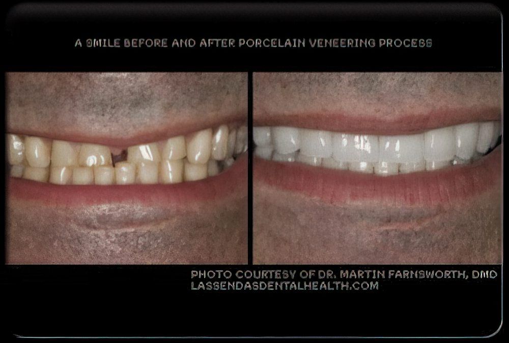 Cosmetic Dentist In Las Sendas Mesa Arizona Ariz AZ Cosmetic Dentist In Las Sendas Mesa Arizona Ariz AZ