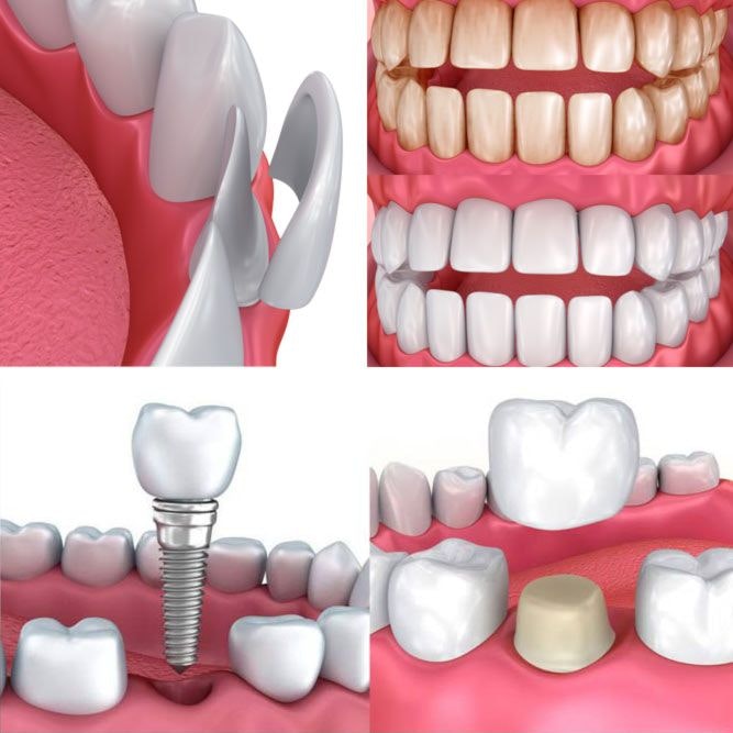 Cosmetic Dentist In Liberty State Park Jersey City New Jersey NJ Cosmetic Dentist In Liberty State Park Jersey City New Jersey NJ