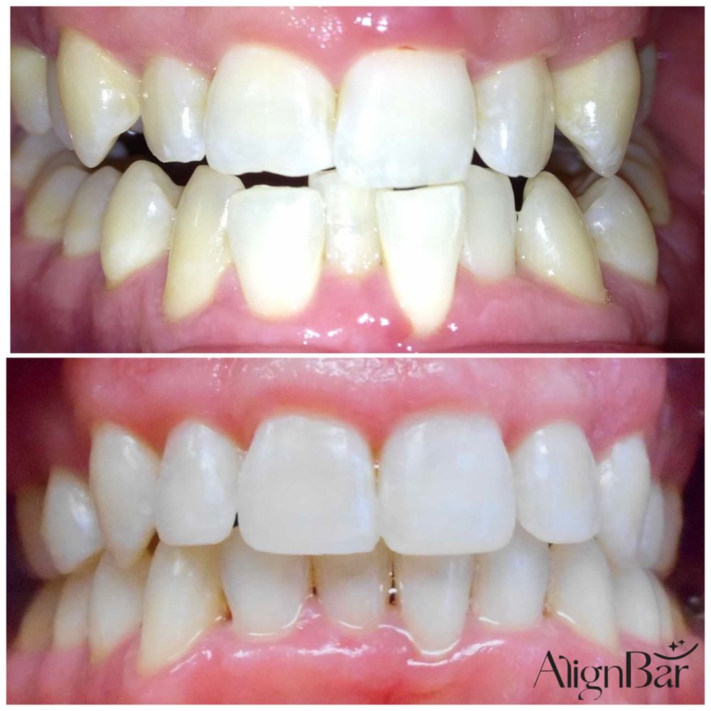 Cosmetic Dentist In Little Italy San Diego California Calif CA Cosmetic Dentist In Little Italy San Diego California Calif CA