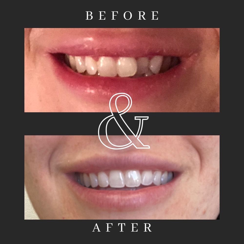 Cosmetic Dentist In Magnolia Avenue Fort Worth Texas TX