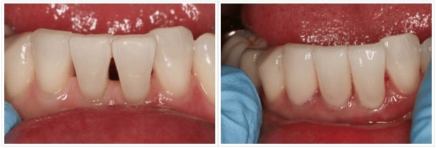 Cosmetic Dentist In Magnolia Distric Stockton California Calif CA Cosmetic Dentist In Magnolia Distric Stockton California Calif CA