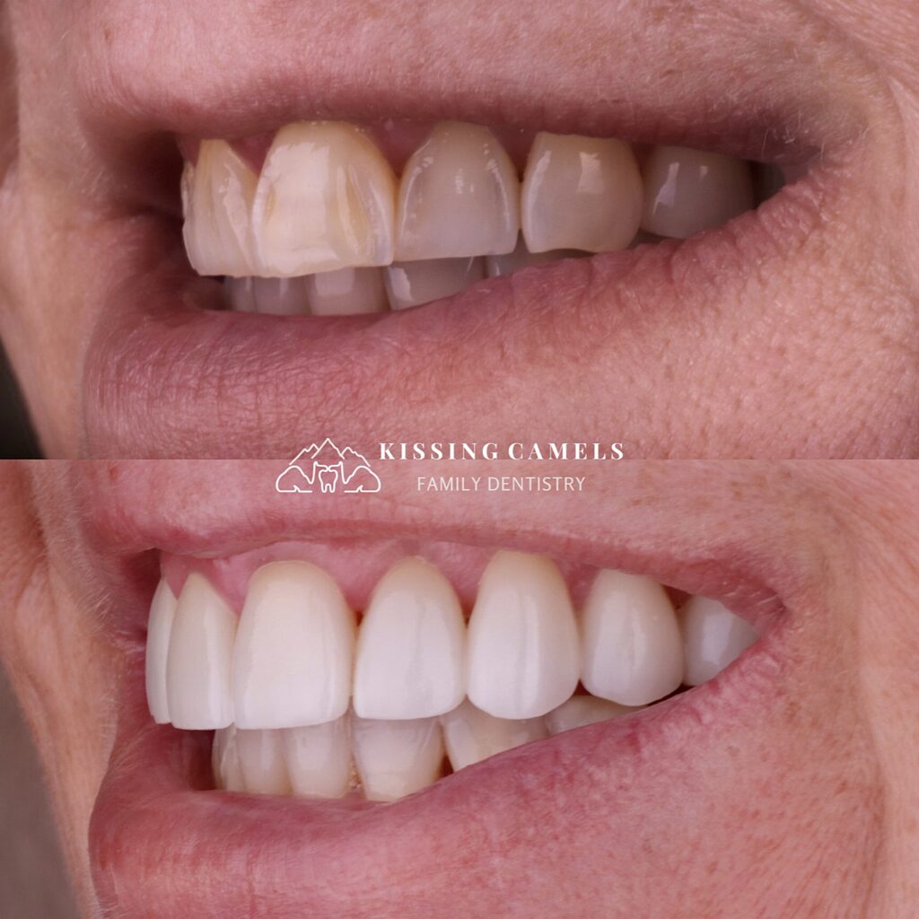 Cosmetic Dentist In Manitou Springs Colorado CO