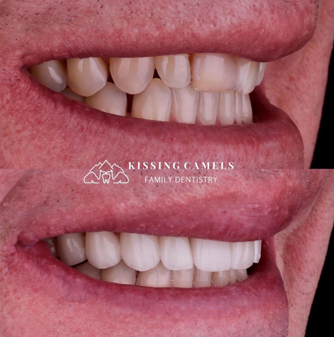 Cosmetic Dentist In Manitou Springs Colorado CO