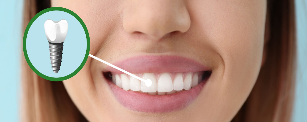 Cosmetic Dentist In Maplewood Adjacent To St Louis Missouri MO Cosmetic Dentist In Maplewood Adjacent To St Louis Missouri MO