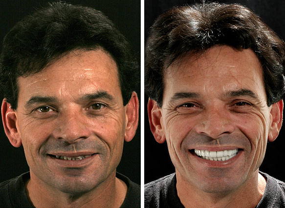 Cosmetic Dentist In Mayfair Fresno California Calif CA