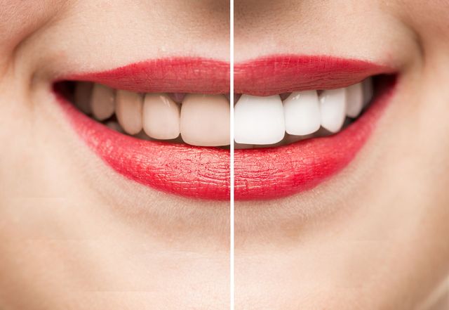 Cosmetic Dentist In McCormick Ranch Scottsdale Arizona Ariz AZ Cosmetic Dentist In McCormick Ranch Scottsdale Arizona Ariz AZ