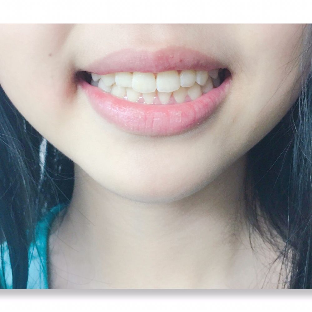Cosmetic Dentist In Moiliili Honolulu Hawaii HI