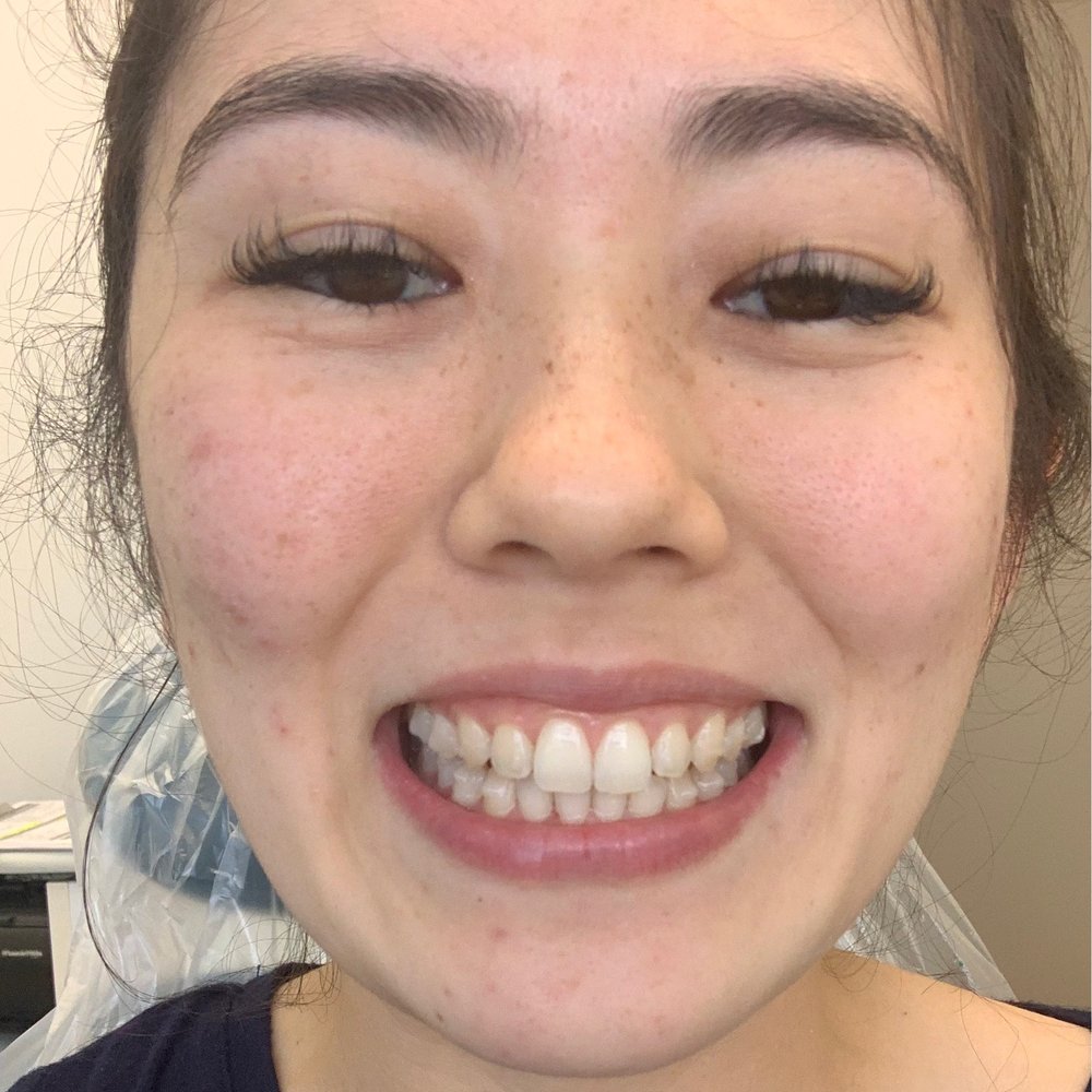 Cosmetic Dentist In Moiliili Honolulu Hawaii HI