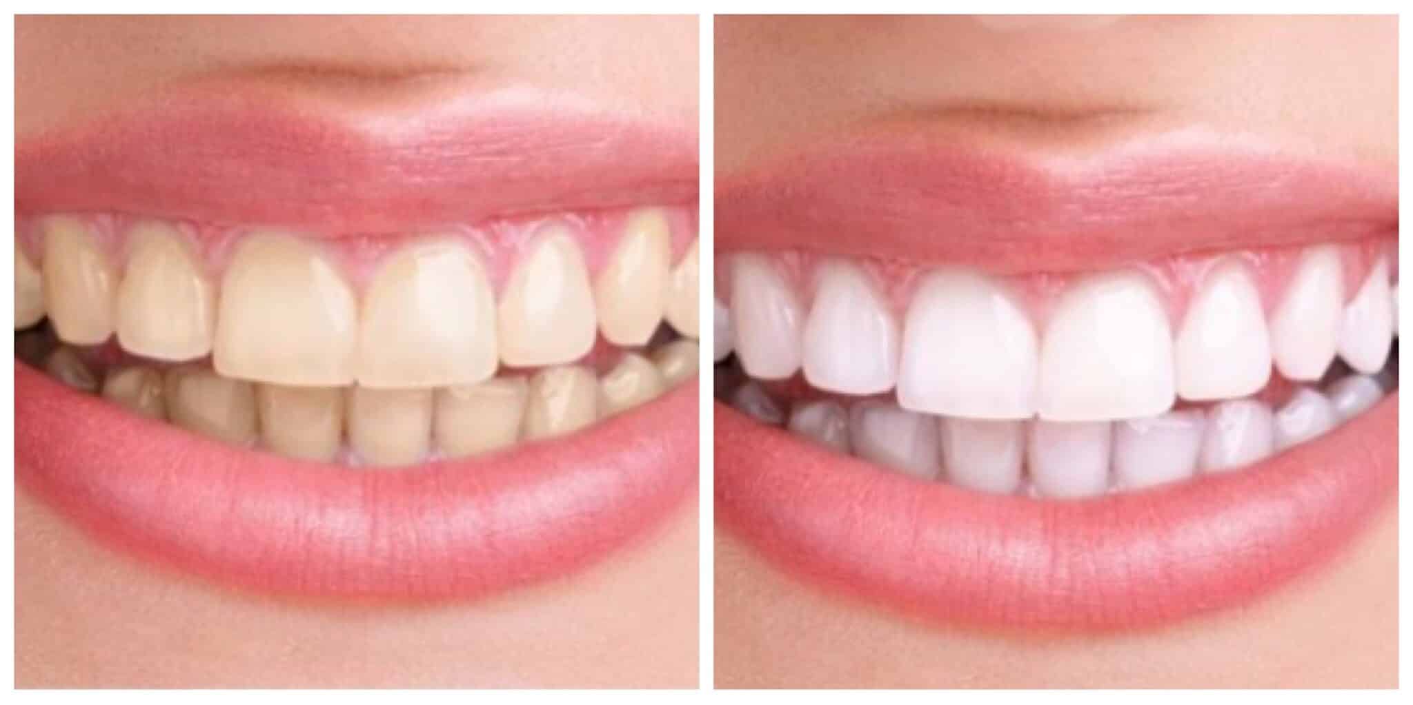 Cosmetic Dentist In Murrieta Oaks Murrieta California Calif CA Cosmetic Dentist In Murrieta Oaks Murrieta California Calif CA