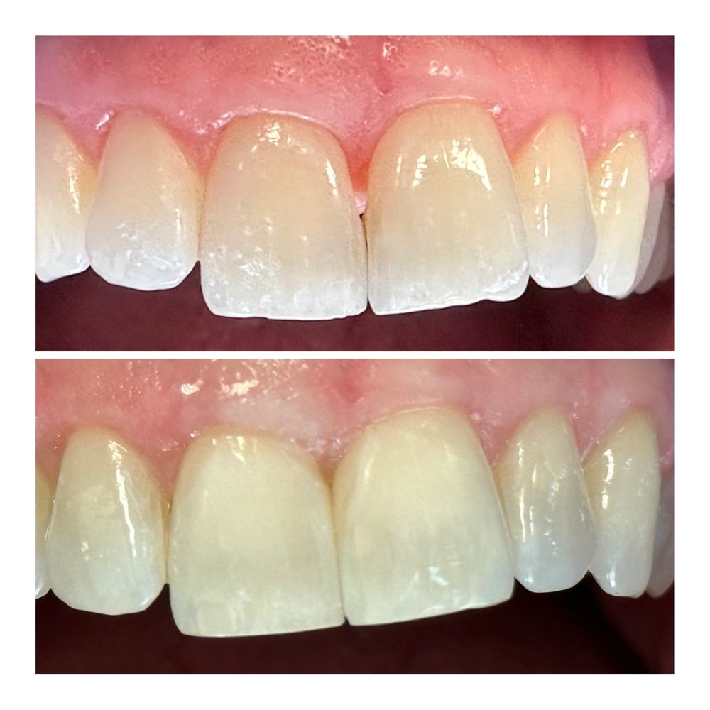 Cosmetic Dentist In Muscoy San Bernardino California Calif CA Cosmetic Dentist In Muscoy San Bernardino California Calif CA