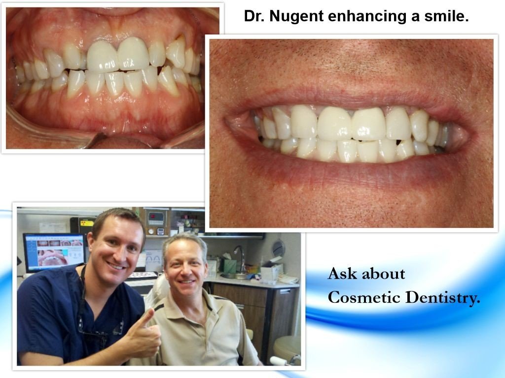 Cosmetic Dentist In North Pasadena Texas TX
