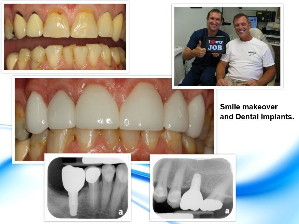 Cosmetic Dentist In North Pasadena Texas TX