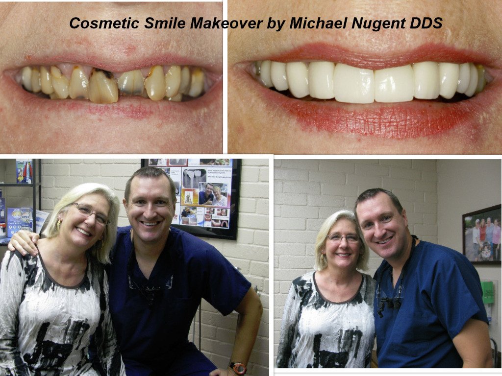 Cosmetic Dentist In North Pasadena Texas TX