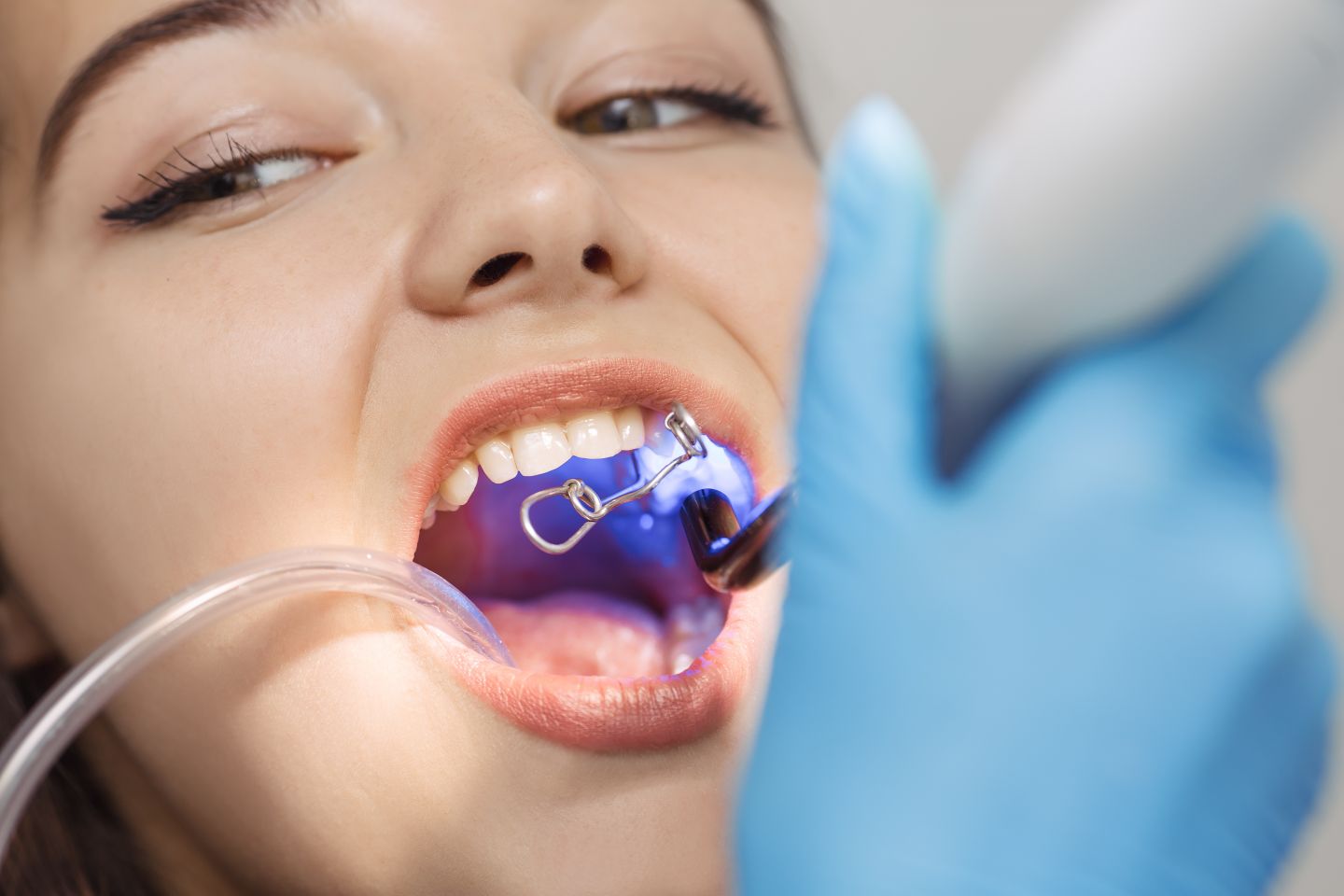 Cosmetic Dentist In Northeast Bakersfield California Calif CA Cosmetic Dentist In Northeast Bakersfield California Calif CA