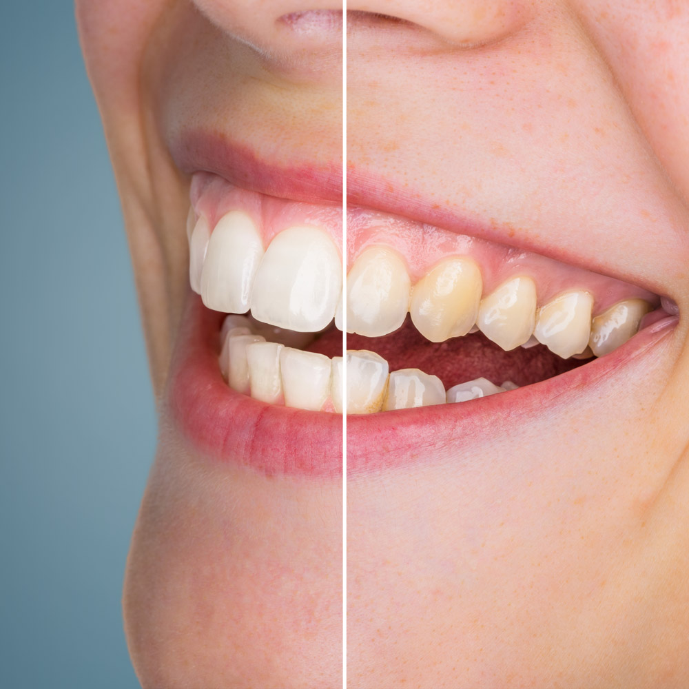 Cosmetic Dentist In Northeast Kansas City Missouri MO