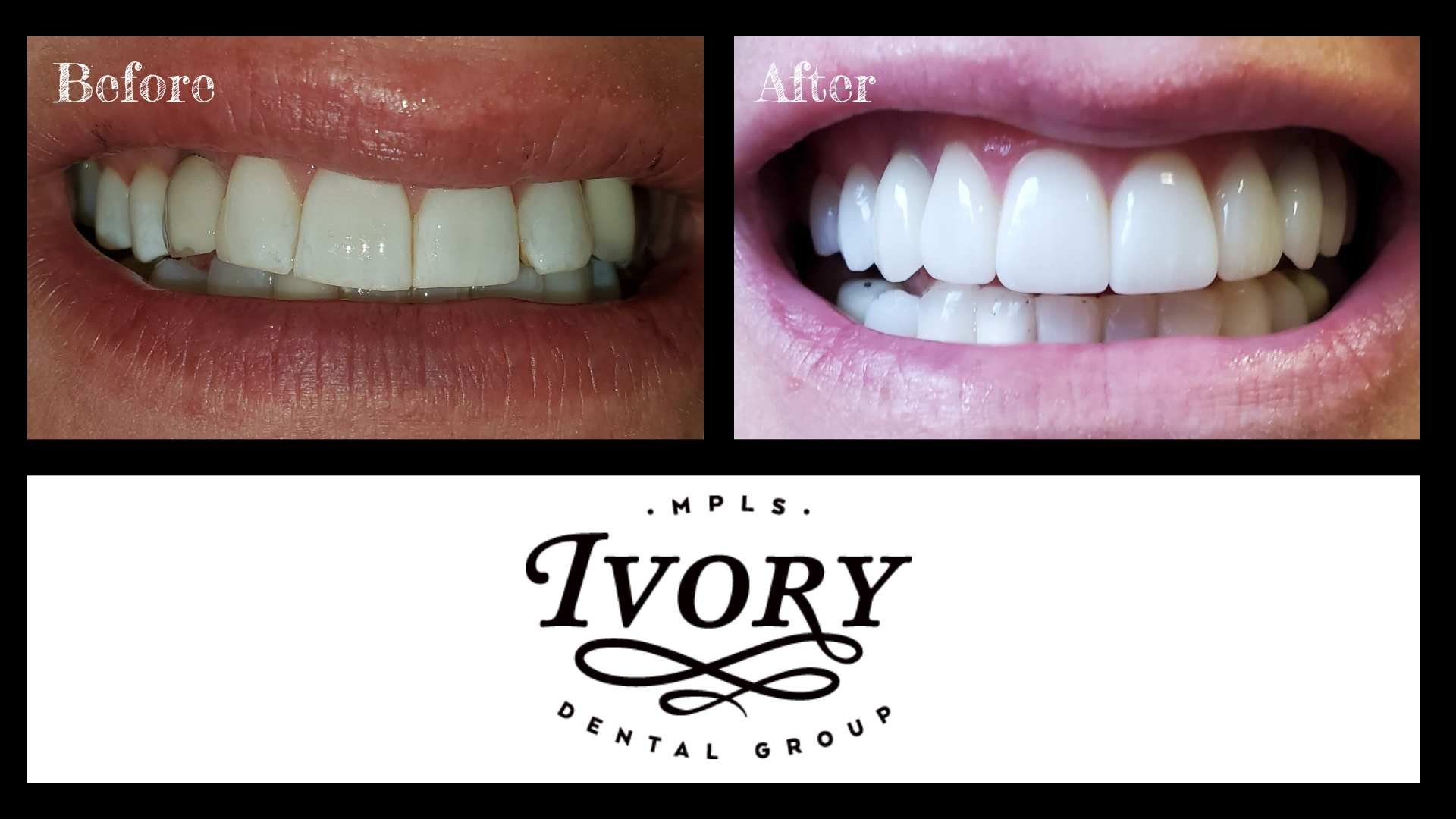 Cosmetic Dentist In Northeast Minneapolis Minnesota Minn MN Cosmetic Dentist In Northeast Minneapolis Minnesota Minn MN