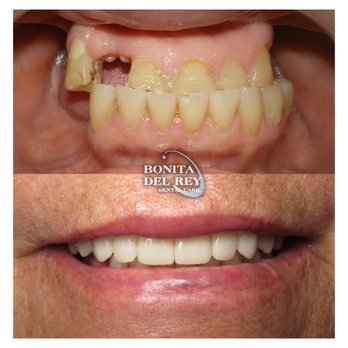 Cosmetic Dentist In Otay Ranch Chula Vista California Calif CA
