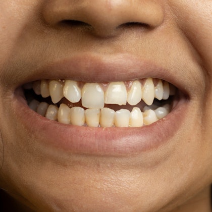 Cosmetic Dentist In Oviedo Adjacent To Orlando Florida Fla FL Cosmetic Dentist In Oviedo Adjacent To Orlando Florida Fla FL