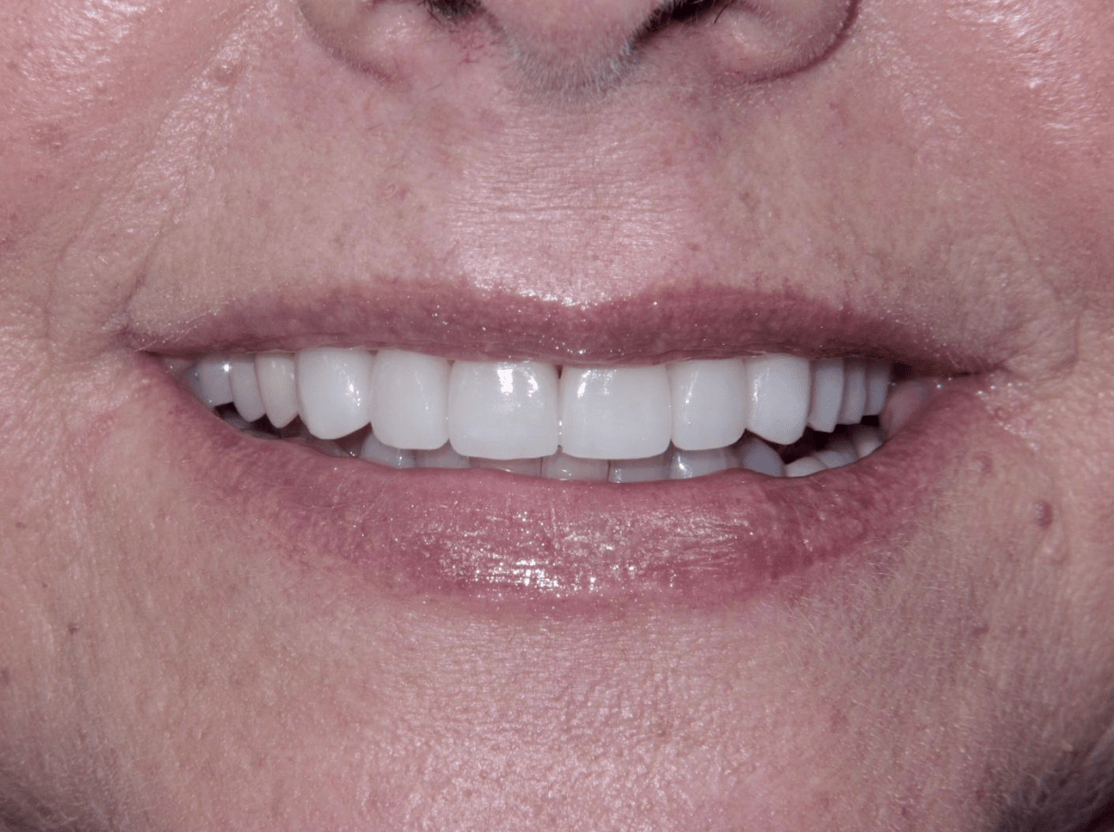 Cosmetic Dentist In Owasso Adjacent To Tulsa Oklahoma Okla OK