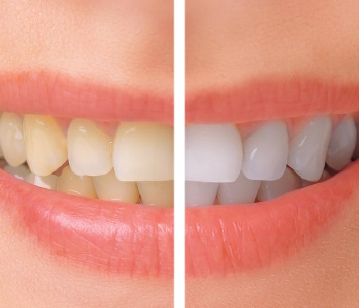 Cosmetic Dentist In Paradise Valley Adjacent To Scottsdale Arizona Ariz AZ Cosmetic Dentist In Paradise Valley Adjacent To Scottsdale Arizona Ariz AZ