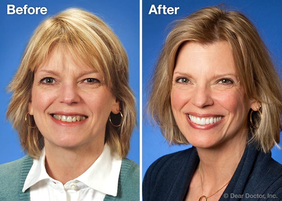 Cosmetic Dentist In Plateau Mobile Alabama Ala AL Cosmetic Dentist In Plateau Mobile Alabama Ala AL