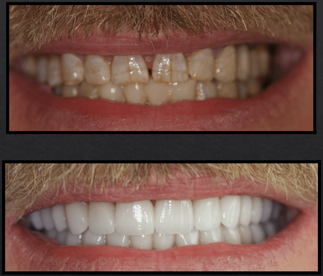 Cosmetic Dentist In Plemons Eakle Amarillo Texas TX